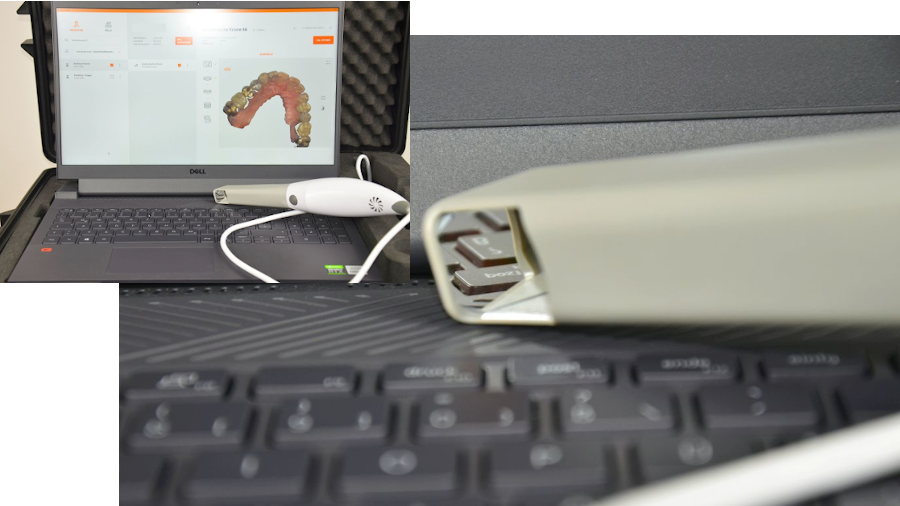 Bild Intraoralscanner